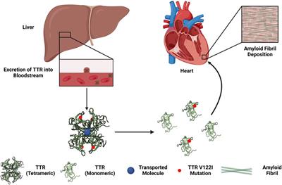 Current and potential therapeutic strategies for transthyretin cardiac amyloidosis